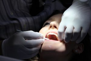 Zubní implantáty a jejich cena